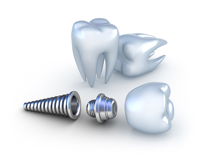 Our titanium products are ideal for manufacturing dental implants